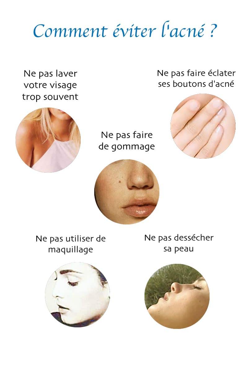 éviter l'acné